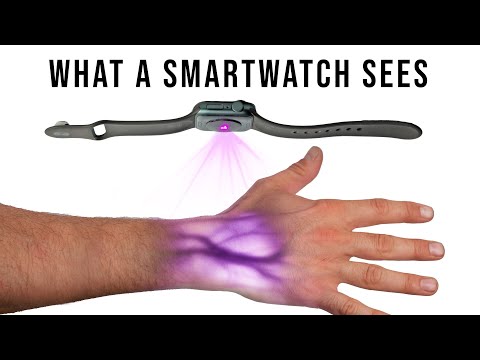 Wie eine Smartwatch in unseren Körper schauen kann lyteCache.php?origThumbUrl=https%3A%2F%2Fi.ytimg.com%2Fvi%2FBFZxlauizx0%2Fhqdefault 