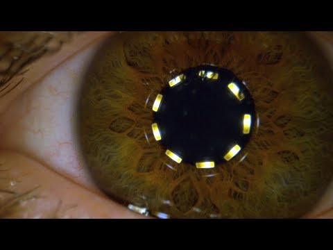 Makro-Superzeitlupe einer sich zusammenziehenden Pupille lyteCache.php?origThumbUrl=https%3A%2F%2Fi.ytimg.com%2Fvi%2FEjIbmQsWtqc%2F0 