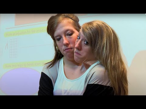 Das siamesische Zwillingspaar Abby und Britt lyteCache.php?origThumbUrl=https%3A%2F%2Fi.ytimg.com%2Fvi%2FcbIPVo4XnLI%2Fhqdefault 