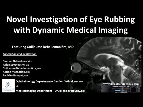 So sieht Augenreiben im MRI-Bild aus lyteCache.php?origThumbUrl=https%3A%2F%2Fi.ytimg.com%2Fvi%2FtM4z3MYZeNk%2F0 