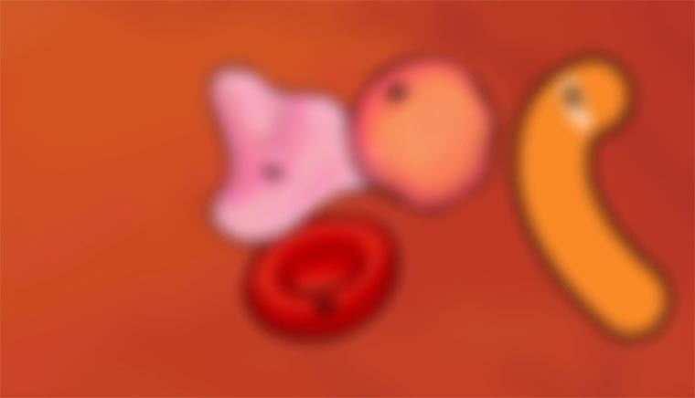 Woher kommen die Schwimmkörper im Auge?