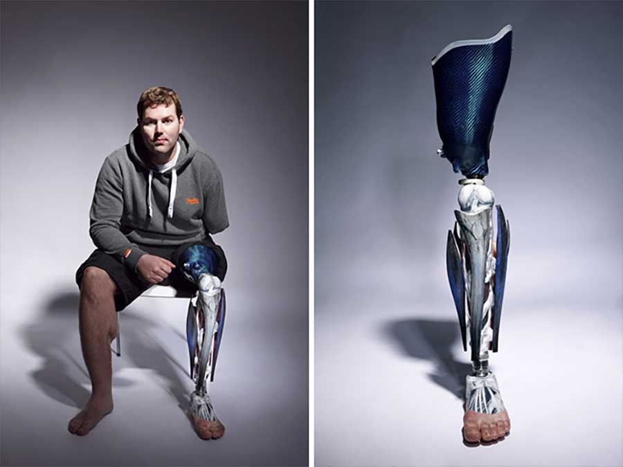 Ausgefallene Prothesen The-Alternative-Limb-Project-Sophie-de-Oliveira-Barata_08 