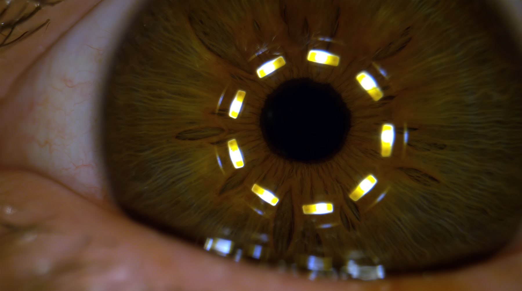 Makro-Superzeitlupe einer sich zusammenziehenden Pupille pupille-supernah-makro-zeitlupe 